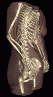 Skeleton from Visible Human Project