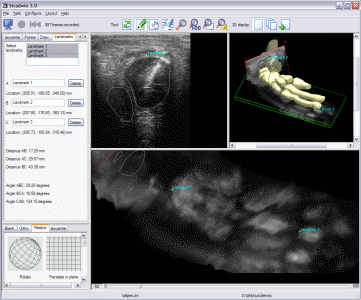Stradwin Screenshot