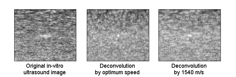 Deconvolution by optimum speed of sound in in-vitro phantom