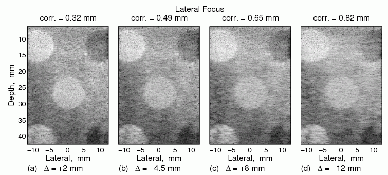 Sensitivity to lateral focus