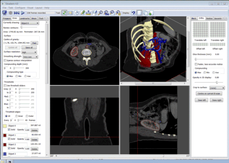 CT data from a DICOM file