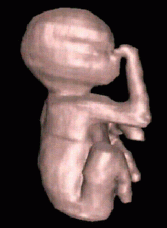 Foetus - shape based interpolation