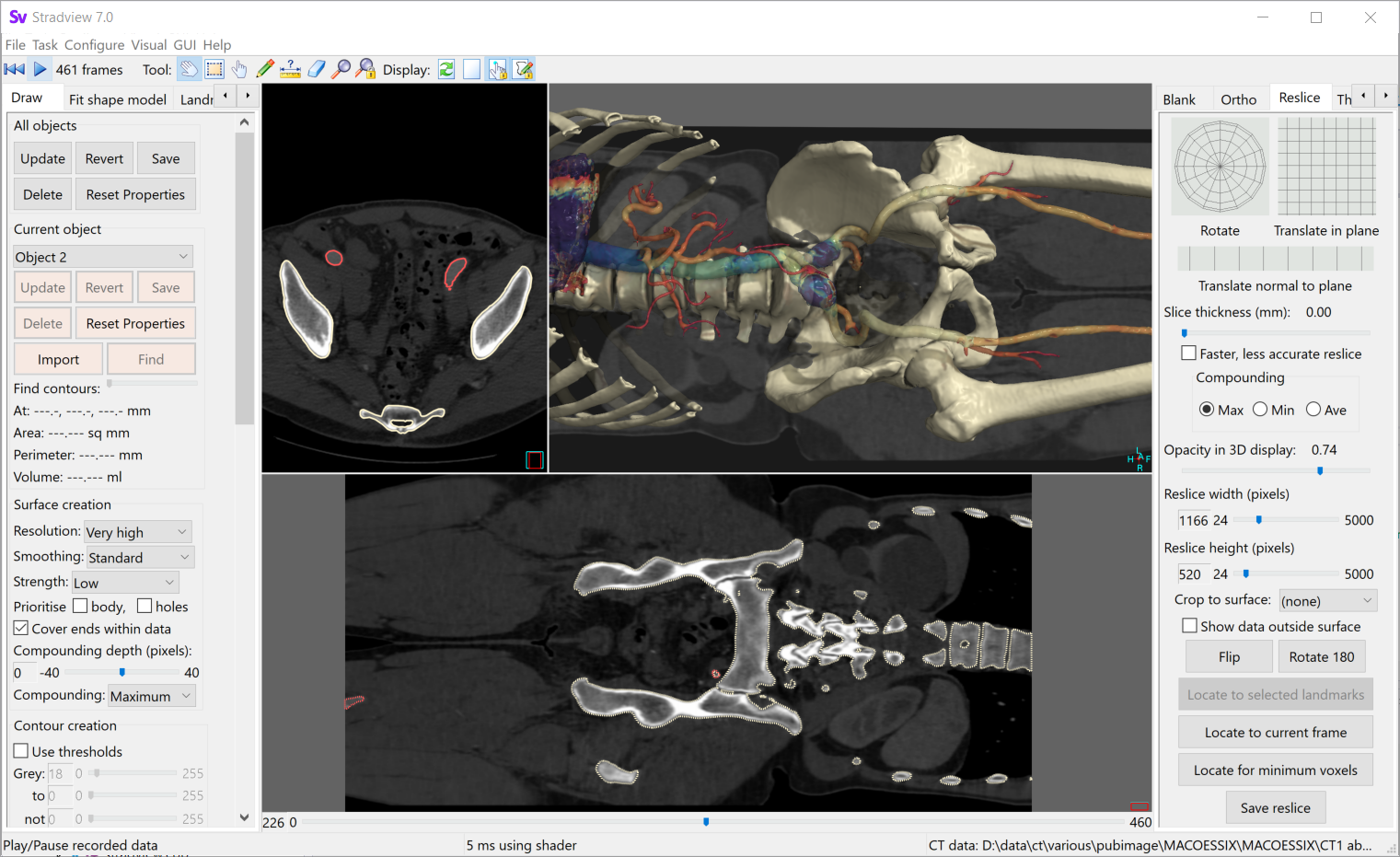 Whole-skeleton segmentation from CT data
